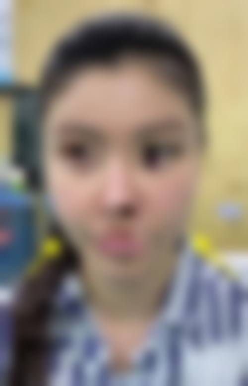 九、广东顺德广大医美整形真实的患者评价