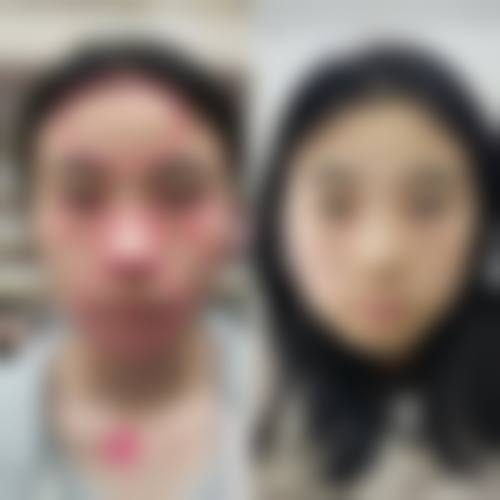 二、广东顺德广大医美整形怎么样？