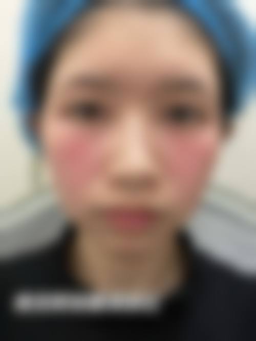 七、安徽医 科 大学第一附属医院(整形外科)预约方式