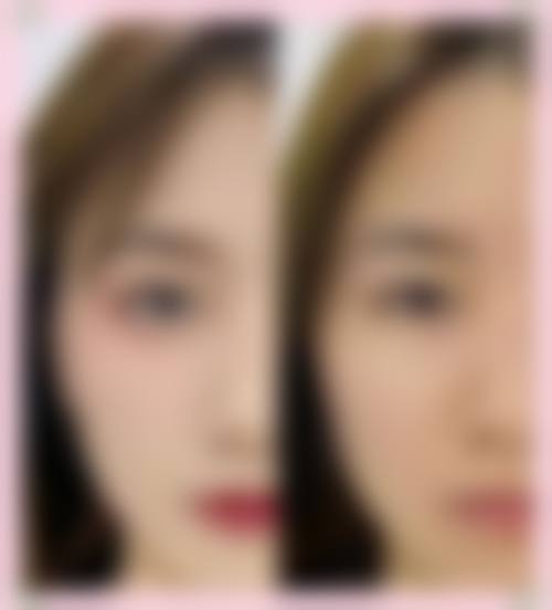 四、广东顺德广大医美整形特色项目