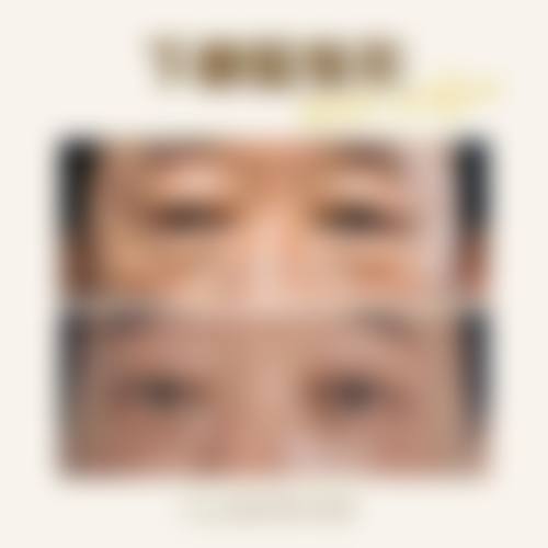 六、广东顺德广大医美整形价格表