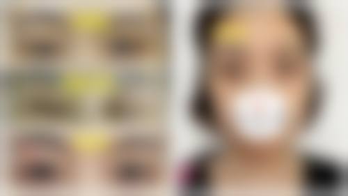 五、新疆伊丽莎白整形医院价格表