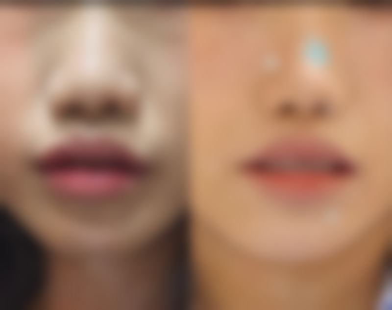 二、安顺丽都(爱美丽)医疗美容诊所怎么样？