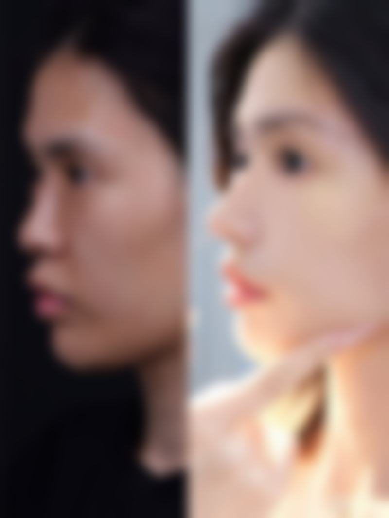 二、广汉熹亚七度整形医院怎么样?