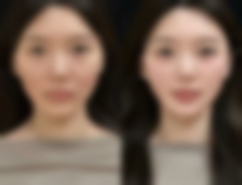 二、科学护理，这些消肿关键要记牢！