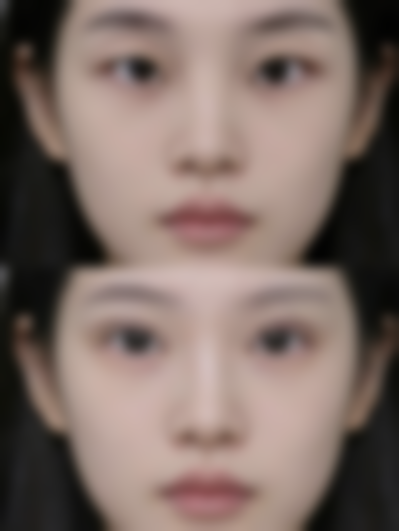 二、韩国SIGNATURE整形外科怎么样？