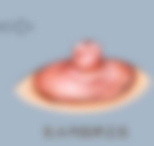 六、术后修复注意事项