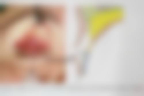 一、双眼皮拆线与免拆线的方式对比