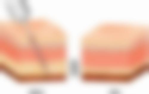 四、雅安市红十字医院整形美容科特色项目