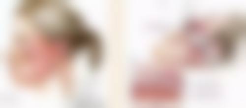 二、吸脂定位双眼皮的适用人群