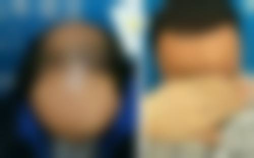 三、合肥源森植发医院诊疗项目有哪些?