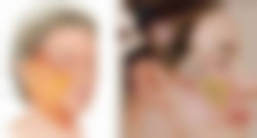 一、打国产瘦脸针,了解其作用原理特别重要