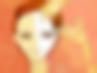 三、吸脂定位双眼皮的术后成效