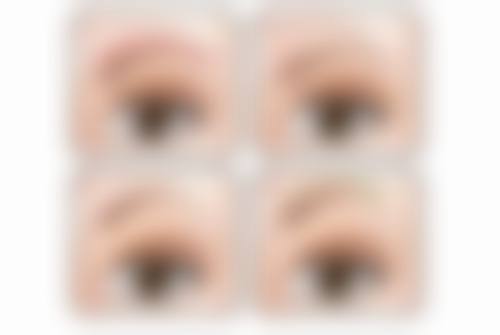 二、打国产瘦脸针的核心优势有哪些