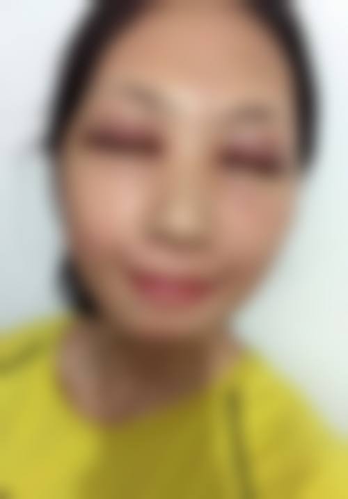 四、深圳腋秀腋臭医疗门诊部特色项目