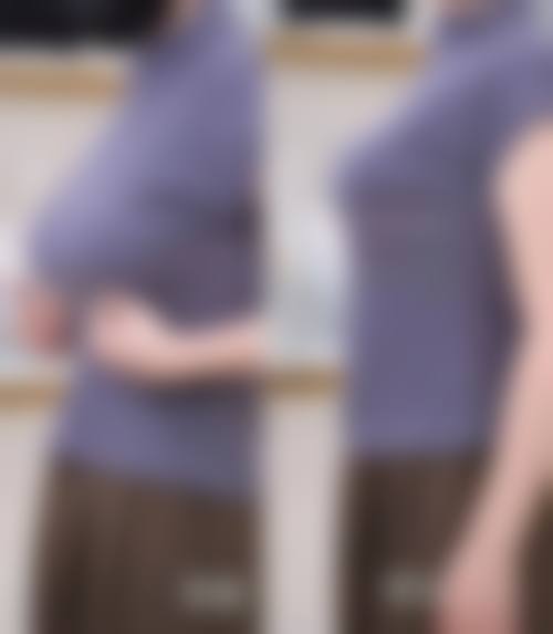 三、雅安市红十字医院整形美容科诊疗项目有哪些？