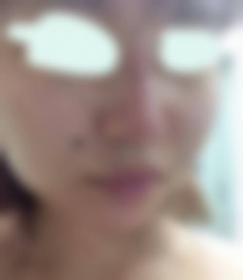 三、北京新颜兴医疗美容医院诊疗项目有哪些？