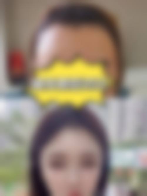 八、合肥源森植发医院真实的患者评价