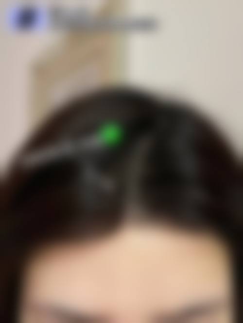 二、合肥源森植发医院怎么样?