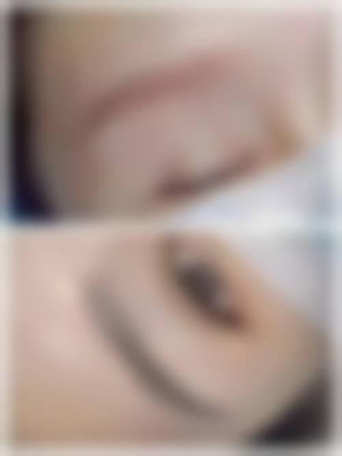 八、东营凤颜整形医院真实的患者评价