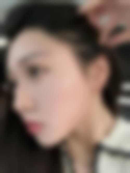 四、衢州伊美医疗美容诊所特色项目