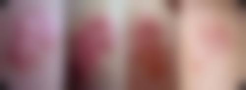 八、雅安市红十字医院整形美容科预约方式