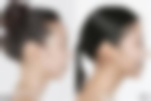 二、深圳维多利亚整形门诊部怎么样？