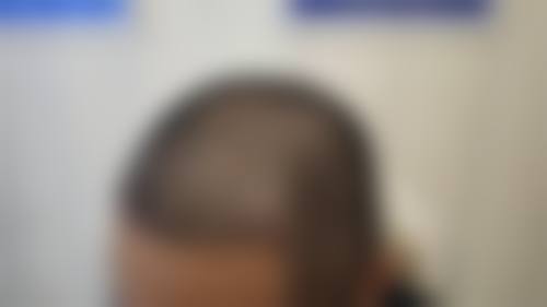 七、深圳腋秀腋臭医疗门诊部预约方式