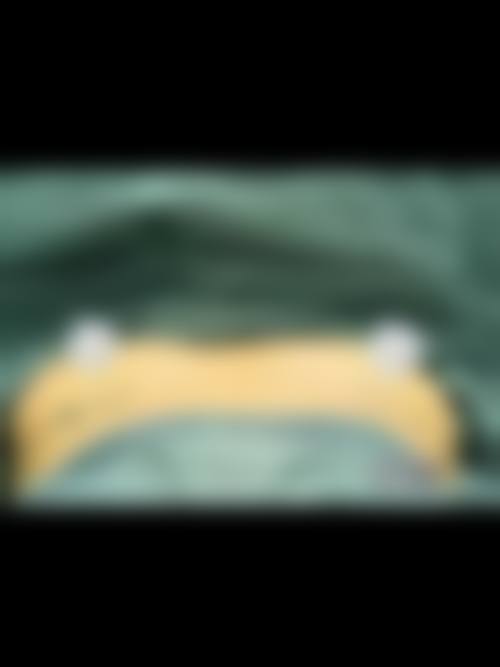 二、韩国三星YUBANG整形外科怎么样？