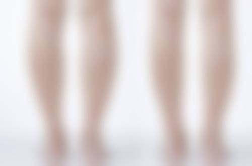 四、福州爱美尔医疗美容特色项目