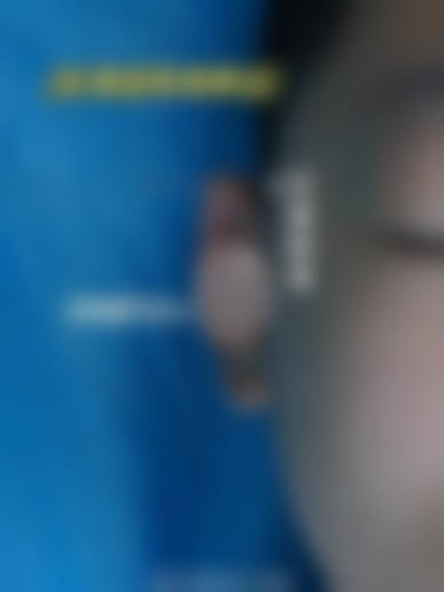 四、太原晋绮医疗美容诊所特色项目