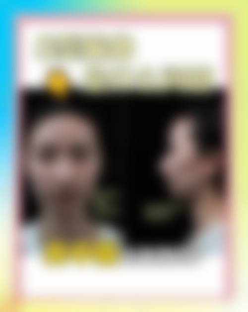 四、文山博文丽予医疗美容诊所特色项目