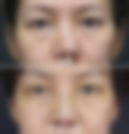 六、太原晋绮医疗美容诊所价格表