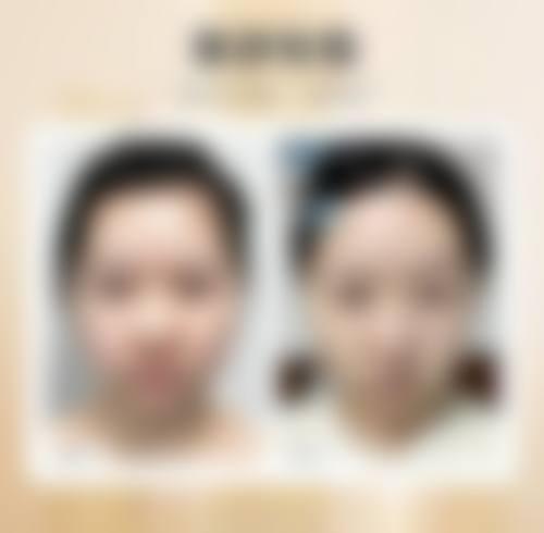 四、阳江恒大整形美容医院特色项目