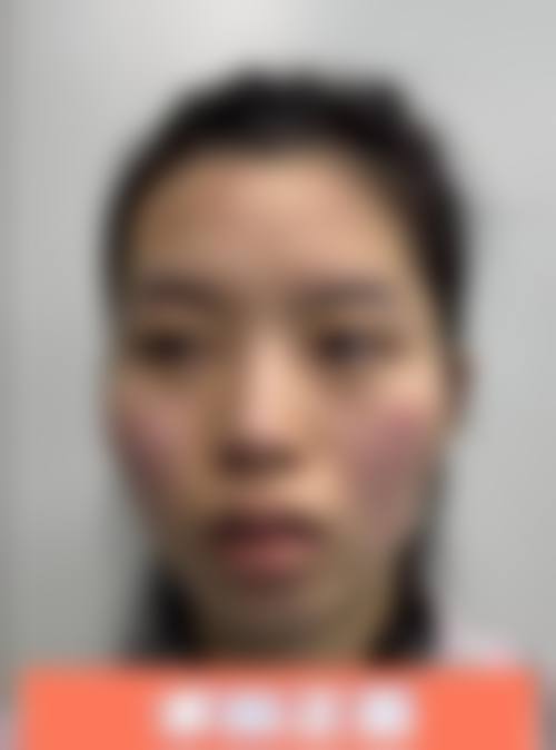 四、济南历下丽容医疗美容诊所特色项目