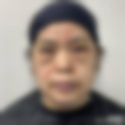 二、北京新颜兴医疗美容医院怎么样？