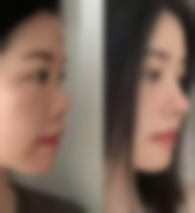 四、北京新颜兴医疗美容医院特色项目