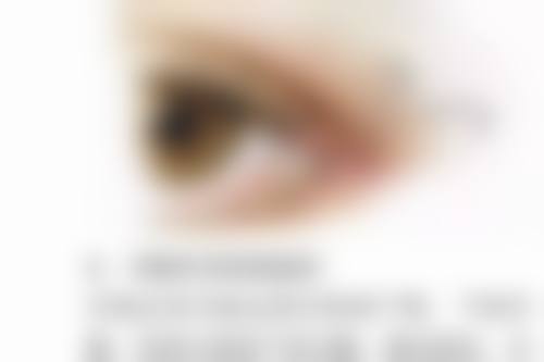 二、女人减肥抽脂的常见风险