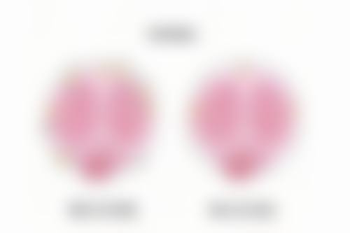 瑞美瑞亚做眼袋怎么样？揭秘无痕去眼袋效果，众多成功案例见证实力！ 