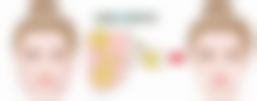 五、选择瑞美瑞亚去眼袋的建议