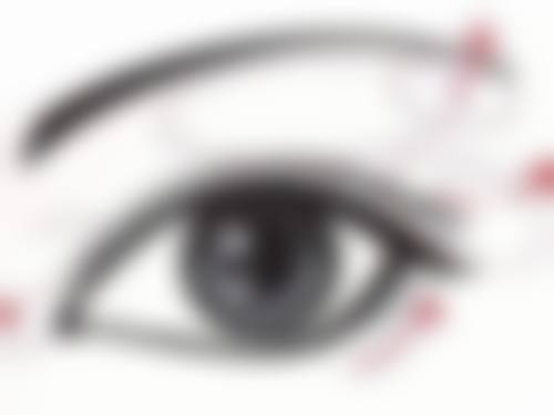 二、衰老引发重度眼袋的机制