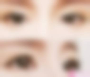 九、上海美蒂菲整形医院真实的患者评价