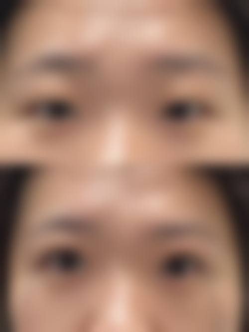 八、吉林赵艳君整形医院真实的患者评价