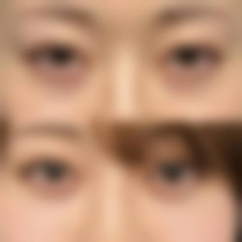 四、上海美蒂菲整形医院特色项目