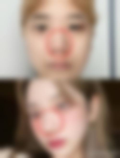 八、上海美蒂菲整形医院预约方式