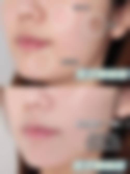 二、赣州星铂丽医疗美容门诊部怎么样？