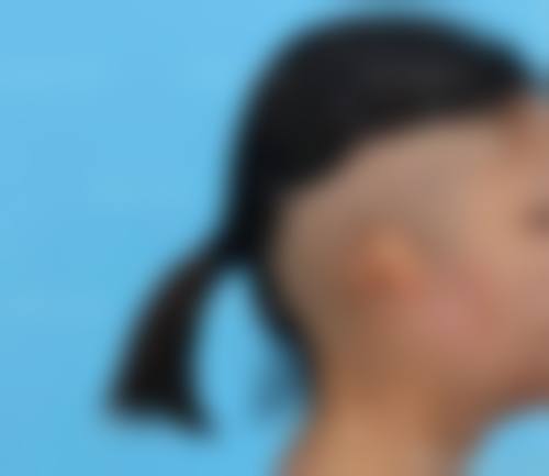 九、南京天玺医疗美容整形医院真实的患者评价