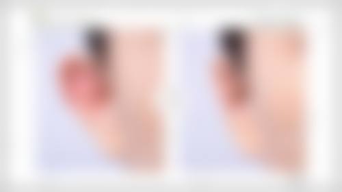 一、惠州元辰整形美容医院正规吗？