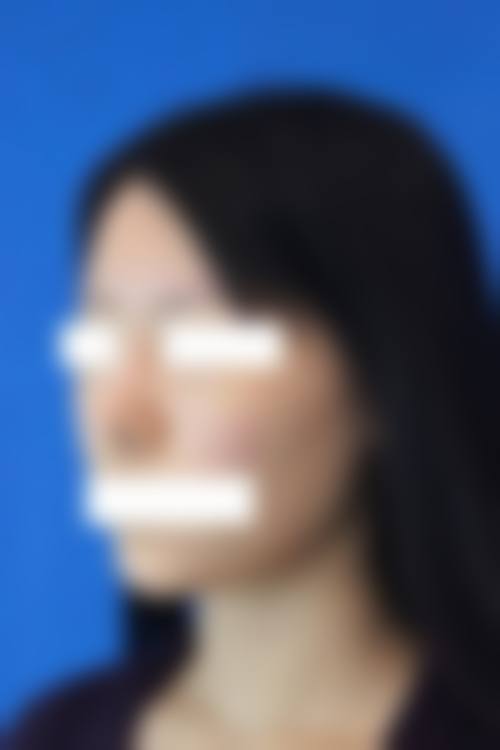 五、广州肤爱整形医院价格表