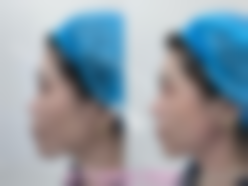 七、吉林赵艳君整形医院预约方式